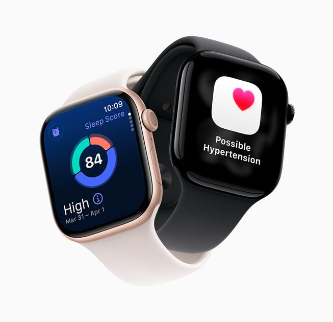 Apple Watch series 11 - Montre trail running - Test et avis